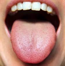 Vapour Tongue عدم الأحساس بطعم اي ليكويد - حل مشكلة ال